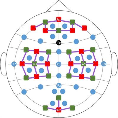 Improved classification performance of EEG-fNIRS multimodal brain-computer interface based on multi-domain features and multi-level progressive learning